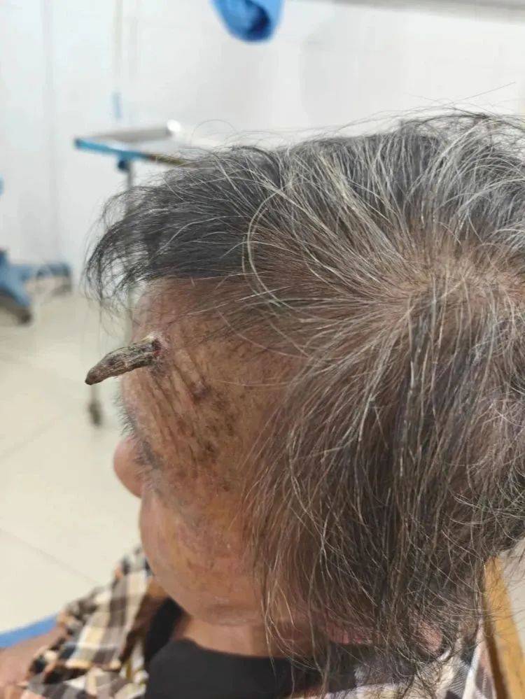 圣保利vs多特蒙德
_太突然!上海98岁阿婆拿起剪刀圣保利vs多特蒙德
,一把剪掉头上的“角”!网友:对自己够狠