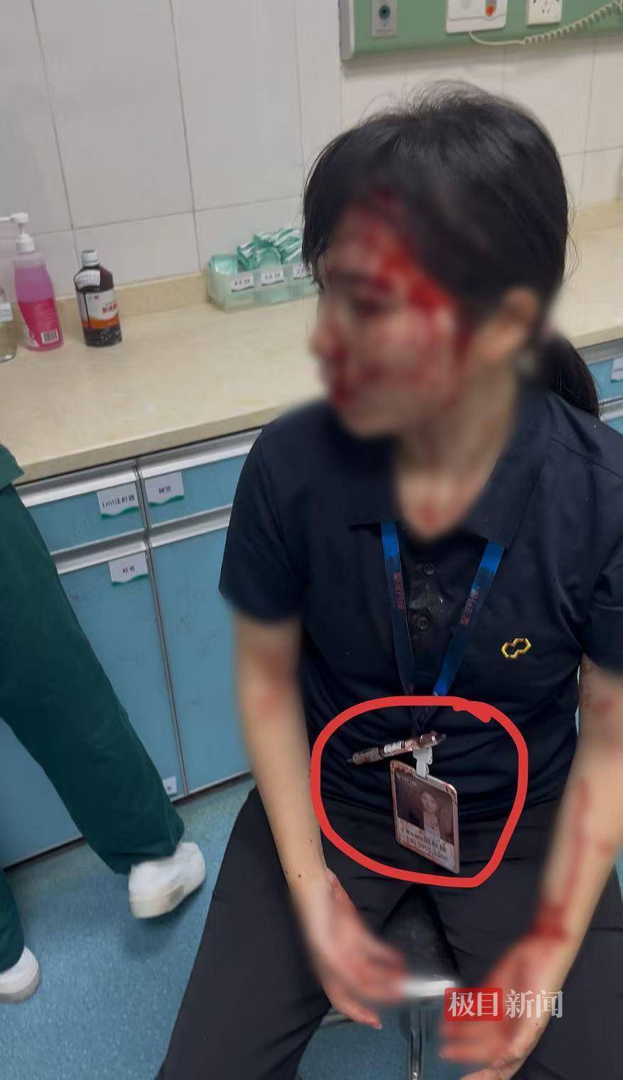 艾斯基斯迈vs洛森格德_“男子持水杯砸伤女同事被刑拘”后续:脸部缝20多针的女子已出院艾斯基斯迈vs洛森格德,否认抢单惹祸