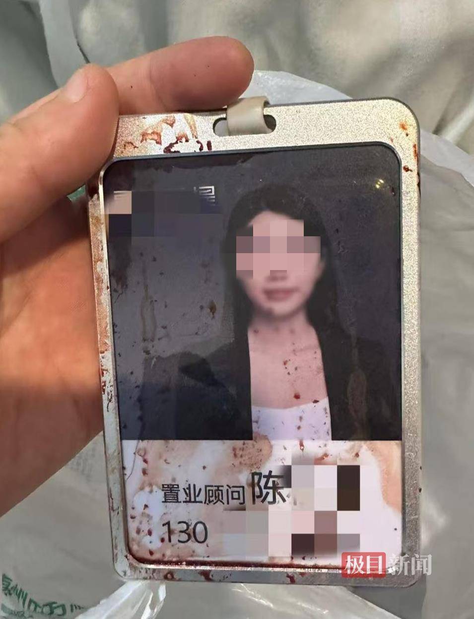 艾斯基斯迈vs洛森格德_“男子持水杯砸伤女同事被刑拘”后续:脸部缝20多针的女子已出院艾斯基斯迈vs洛森格德,否认抢单惹祸