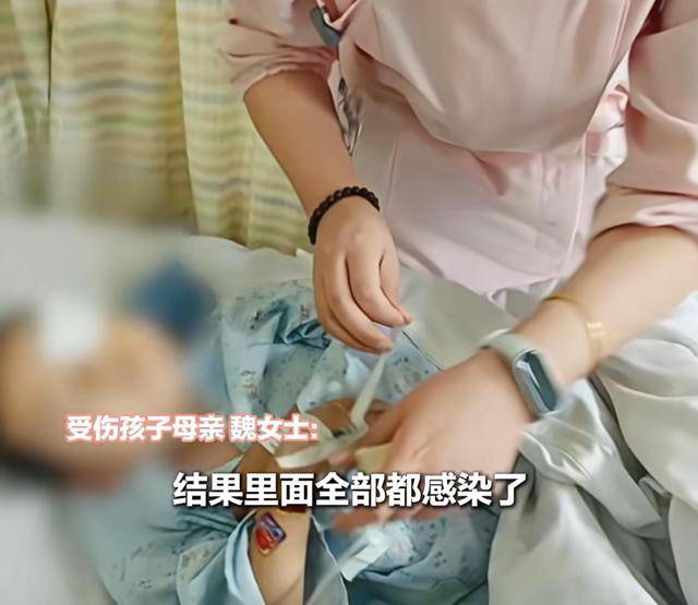 英格兰 vs 威尔士_江西一5岁男孩在幼儿园被戳伤致左眼失明英格兰 vs 威尔士,家长称老师用猪油涂抹试图消肿